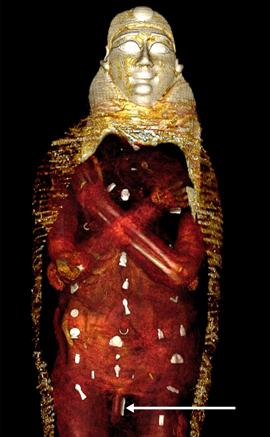 frontiers-medicine-golden-boy-mummy-showcase-egyptian-beliefs_04-1.png